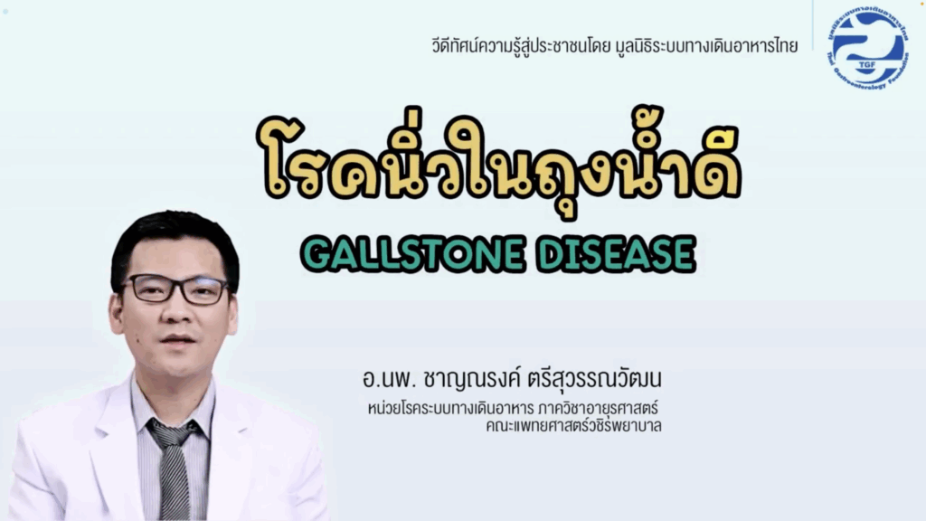 โรคนิ่วในถุงน้ำดี